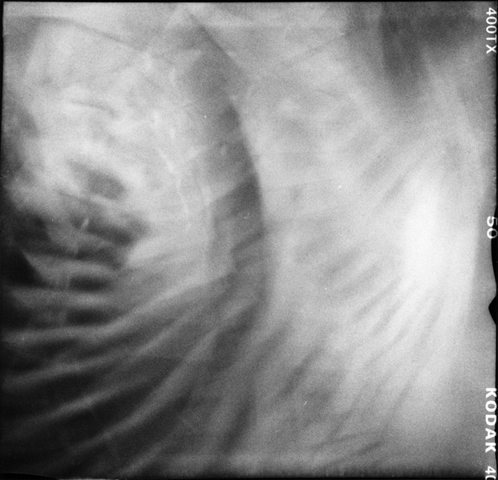 Series #16, Image #2
